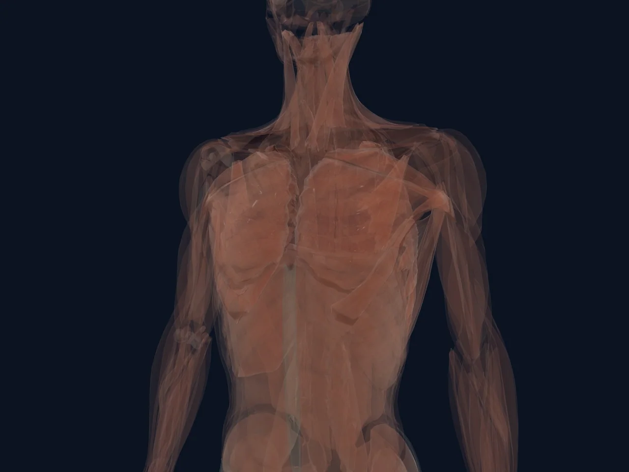 Intercostal Muscles region shown with nearby chest anatomy for orientation.