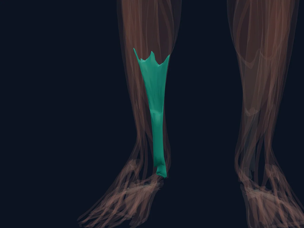 Achilles Tendon highlighted in teal with nearby anatomy shown for orientation.