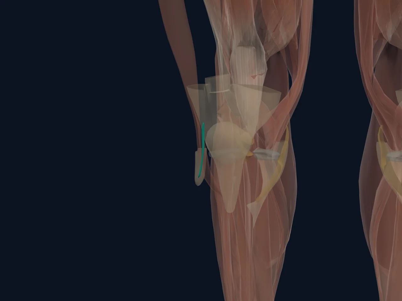Lateral Collateral Ligament (LCL) highlighted in teal with nearby anatomy shown for orientation.