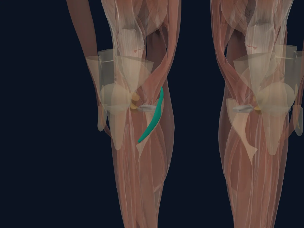 Medial Collateral Ligament (MCL) highlighted in teal with nearby anatomy shown for orientation.