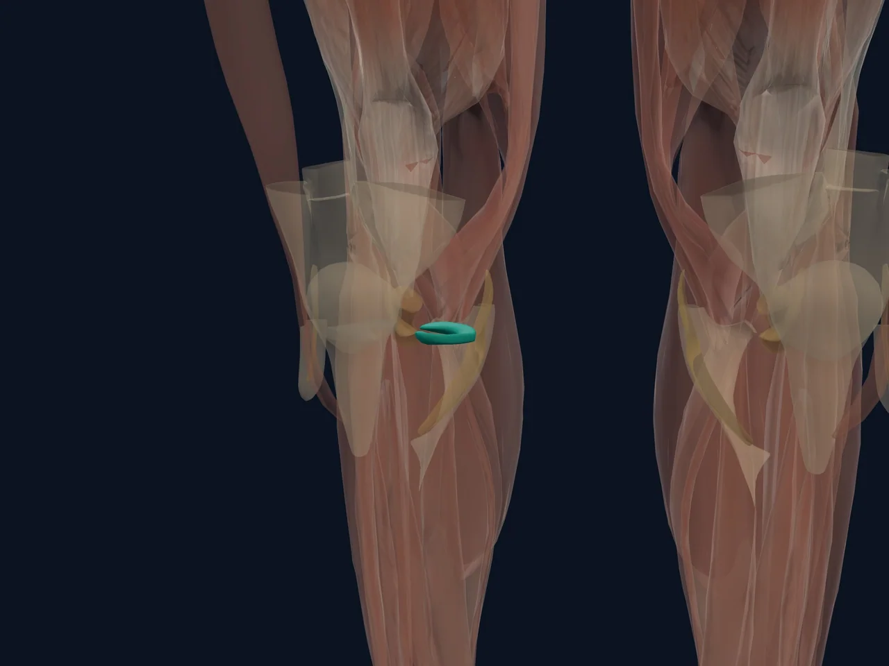 Medial Meniscus highlighted in teal with nearby anatomy shown for orientation.