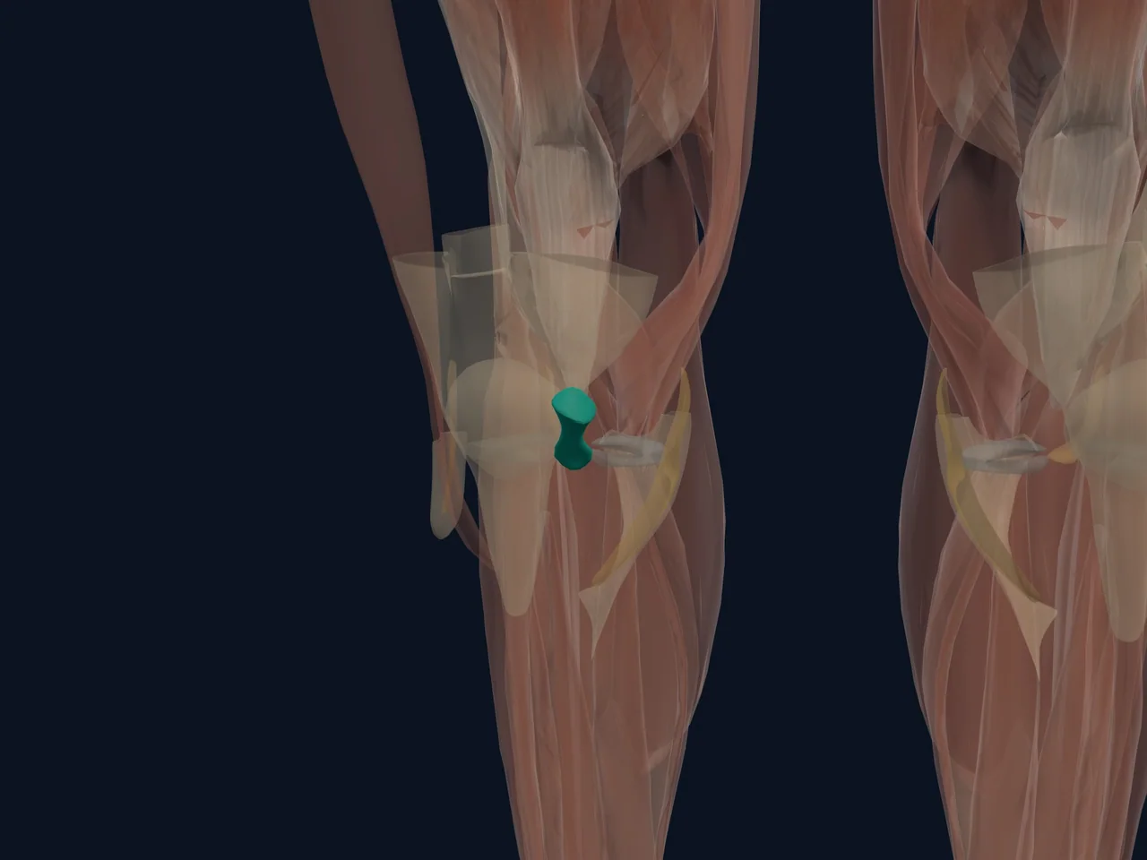 Posterior Cruciate Ligament (PCL) highlighted in teal with nearby anatomy shown for orientation.