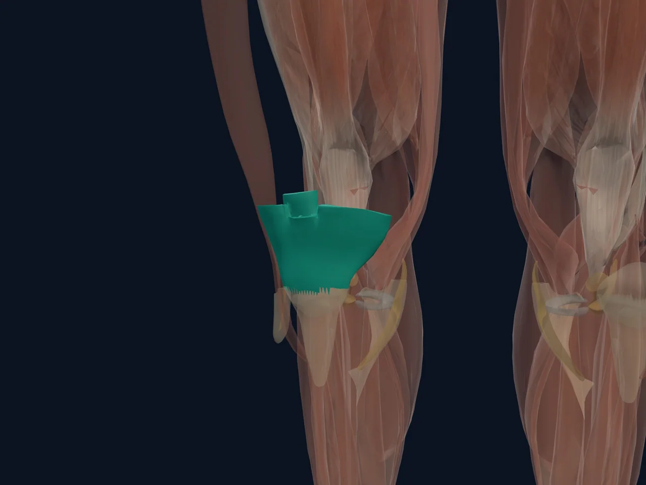 Quadriceps Tendon highlighted in teal with nearby anatomy shown for orientation.