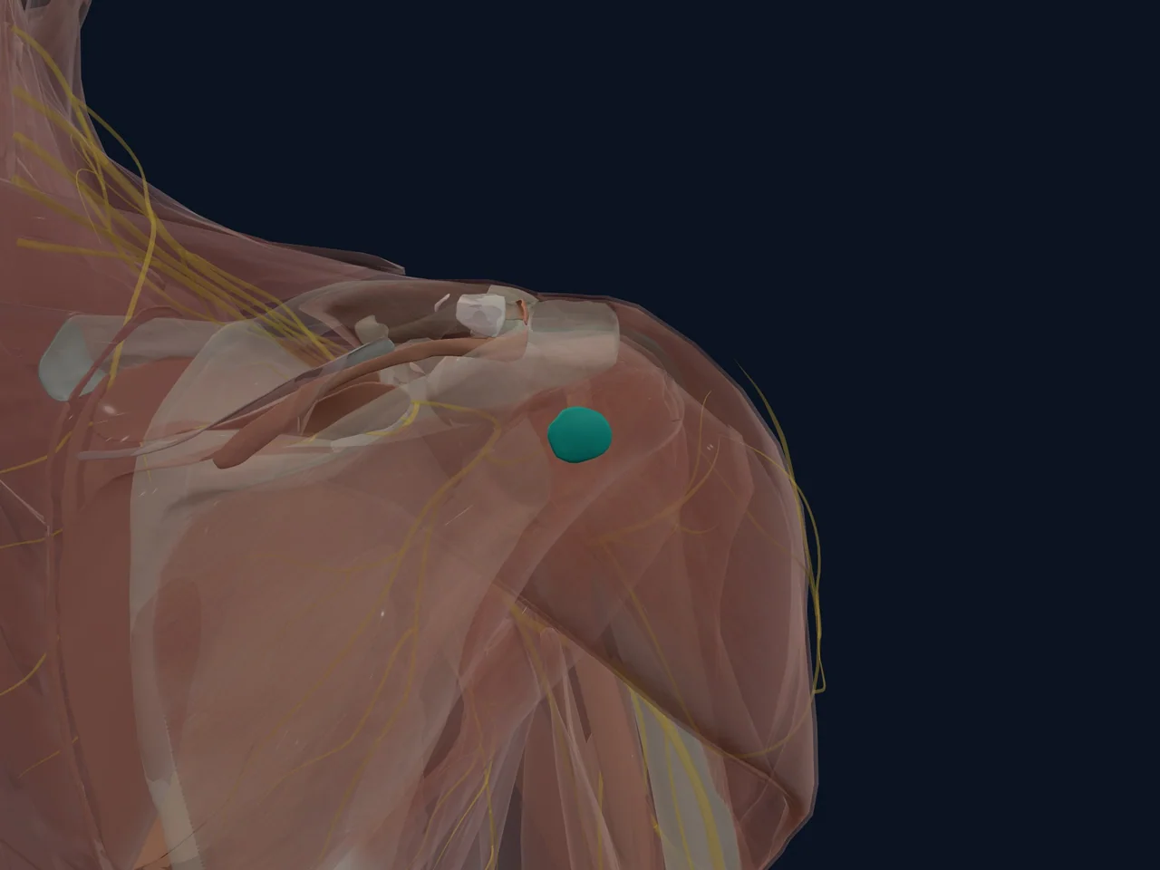 Infraspinatus Bursa highlighted in teal with nearby anatomy shown for orientation.