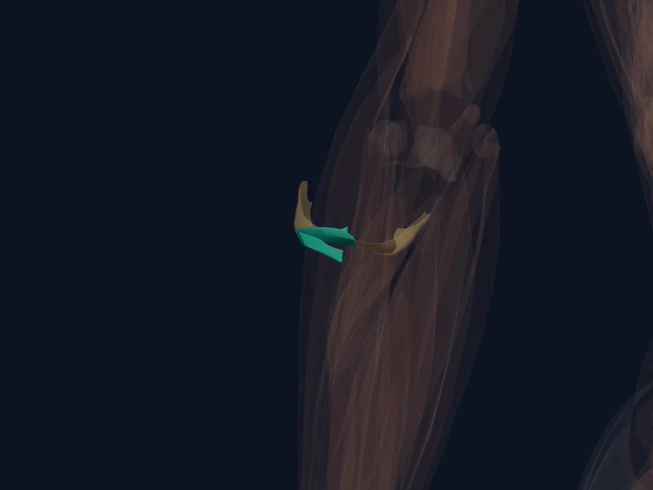 Annular Ligament of the Elbow highlighted in teal with nearby anatomy shown for orientation.