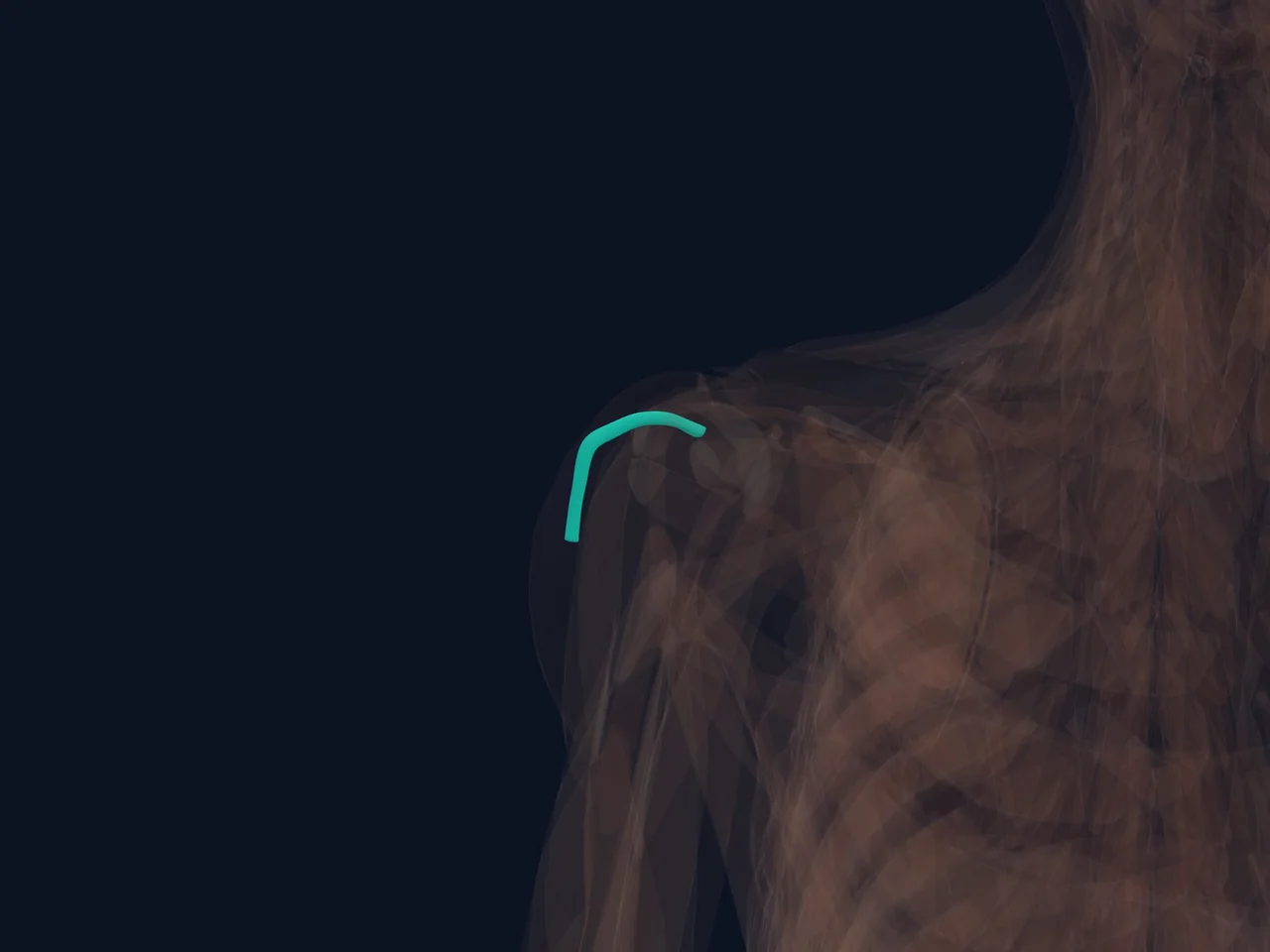 Biceps Tendon Sheath highlighted in teal with nearby anatomy shown for orientation.