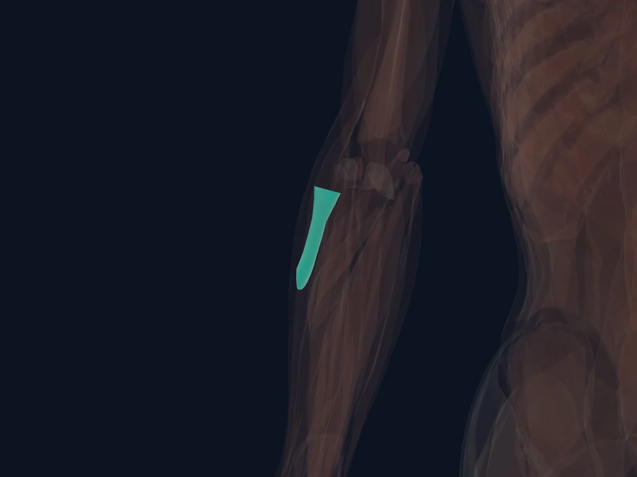 Biceps Tendon (Common) highlighted in teal with nearby anatomy shown for orientation.