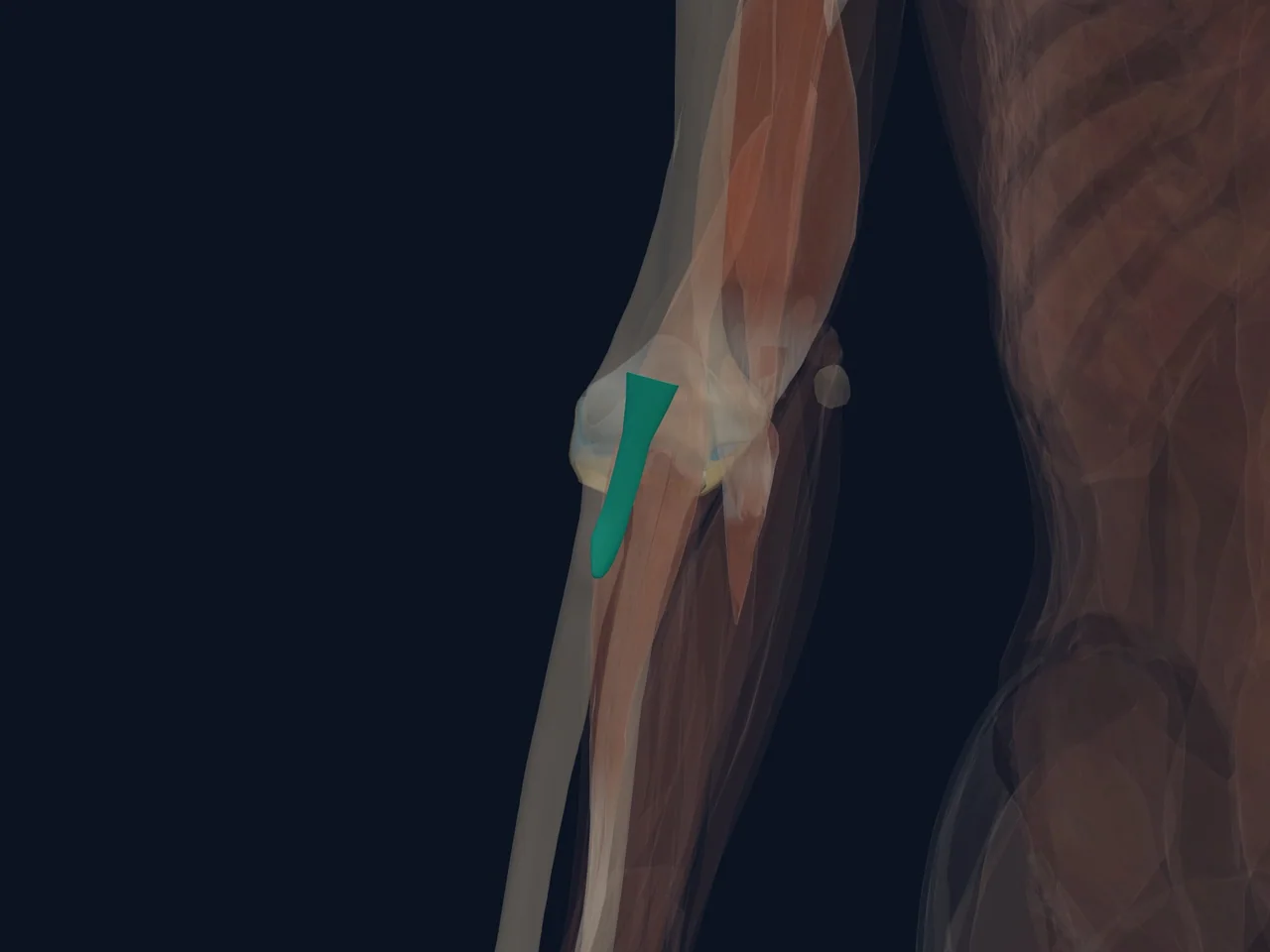Distal Biceps Tendon highlighted in teal with nearby anatomy shown for orientation.