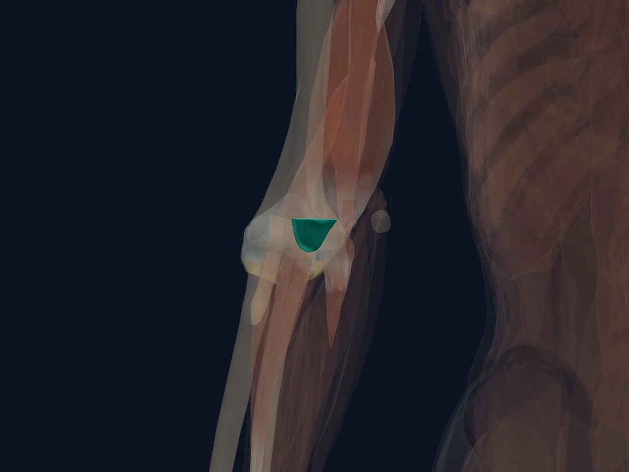 Distal Triceps Tendon highlighted in teal with nearby anatomy shown for orientation.
