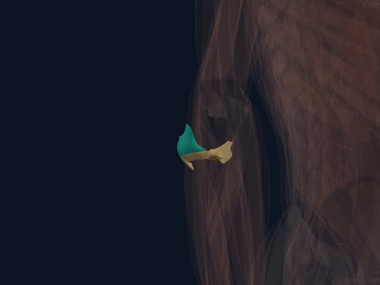 Lateral Elbow Ligament Complex highlighted in teal with nearby anatomy shown for orientation.