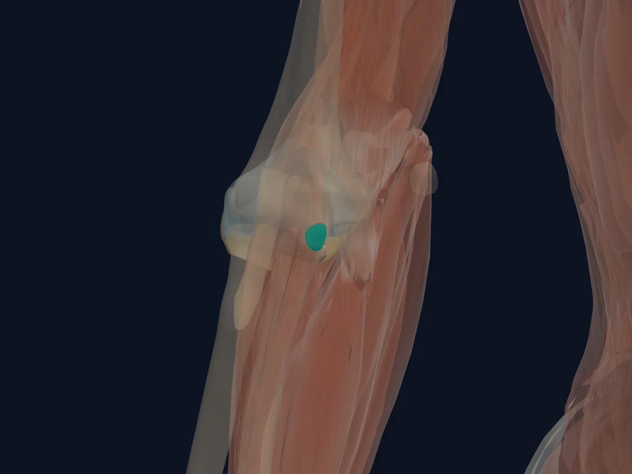 Olecranon Bursa highlighted in teal with nearby anatomy shown for orientation.