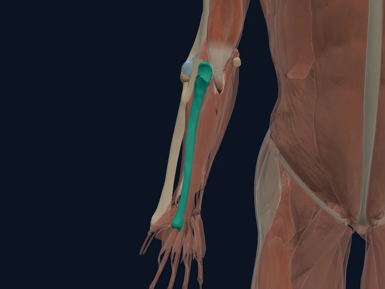 Proximal Ulna and Olecranon highlighted in teal with nearby anatomy shown for orientation.