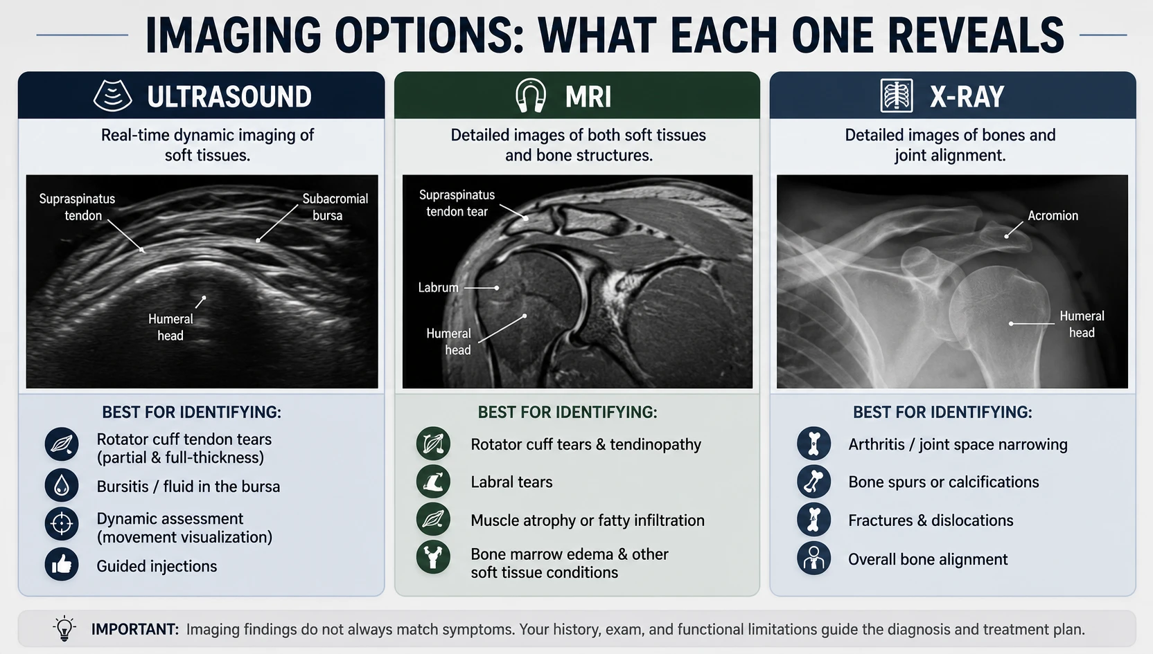 Comparison of what ultrasound, MRI, and X-ray each reveal in the shoulder: ultrasound showing the supraspinatus tendon and subacromial bursa, MRI showing a supraspinatus tendon tear and labrum, and X-ray showing the acromion and humeral head