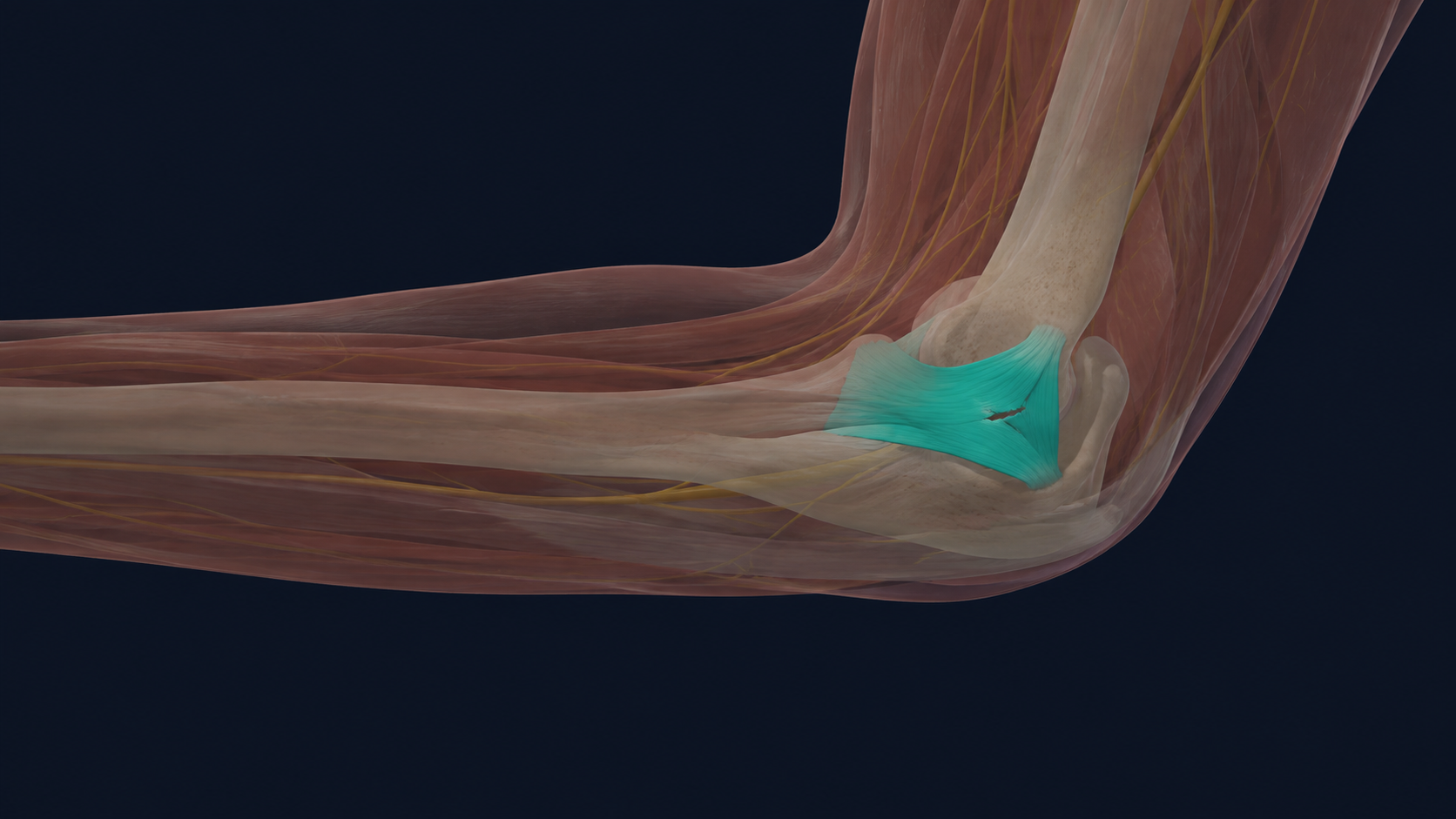 Side-view elbow illustration with the inner ulnar collateral ligament highlighted.
